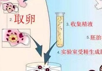 做三代试管婴儿，美国和泰国哪个更好呢？