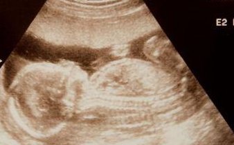 高龄备孕新希望！盘锦人民医院试管费用透明，早行动更安心