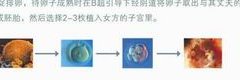 科普指南！泰国第三代试管婴儿技术与其他的区别